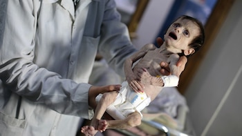 La niña de dos años