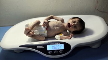 Sahar Dofdaa pesaba menos de