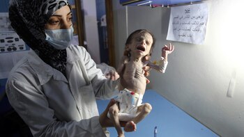 Una enfermera sostiene a la