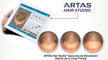 Así es el software que