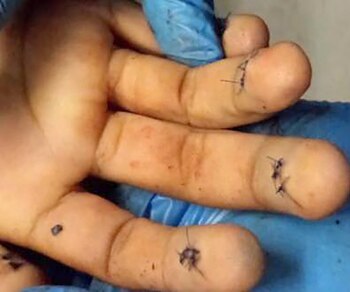 “El Kalimba” intentaba alterar sus