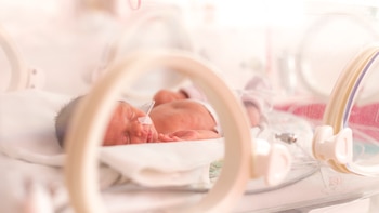 El recién nacido tiene derecho a