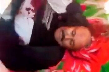 Las imágenes del cadáver fueron