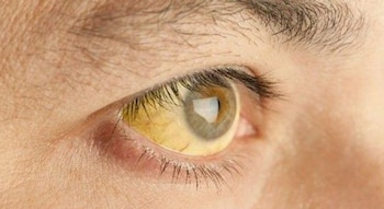 Los signos de un cuadro