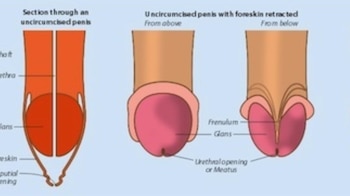 Imagen JBPVXVALYZBR3HLYIO5M6Z64KY