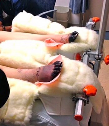 Los pies de Lauren Wasser