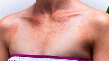 Especialistas aseguran que “el sol