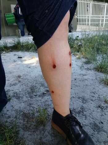 Las huellas de los balazos