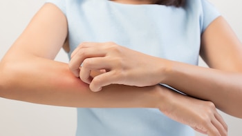 Una de las formas clave