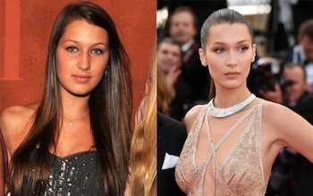 El antes y después de Bella Hadid (Fotos: Archivo Atlántida Televisa).