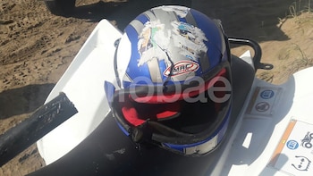 El casco partido de Franco