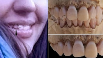 Se prestó especial atención a