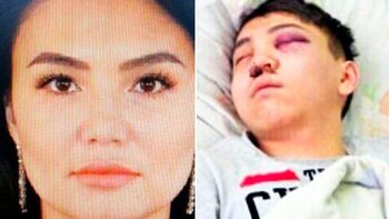 Zhanna Nurzhanova no toleró saber que su novio tenía una amante y decidió cortarle los testículos