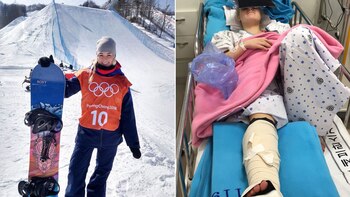 Katie Ormerod no podrá competir en los Juegos Olímpicos de Invierno porque sufrió dos graves lesiones en sus entrenamientos