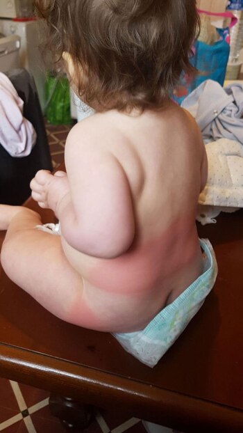 La bebé de 14 meses