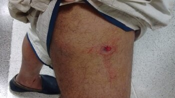 Un hombre recibió tres disparos: