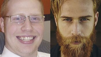 Gwilym Pugh con 40 kilos de más, sin barba y con anteojos. Hoy, con un cambio de look sorprendente arrasa en el mundo de la moda