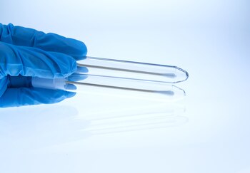 Las consecuencias de los tratamientos para lograr curaciones son mucho menores mientras más temprano se diagnostique el tumor (Getty Images)