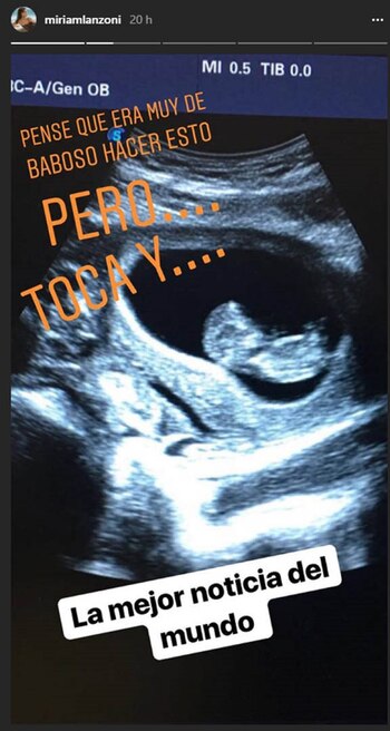 La ecografía que Miriam Lanzoni