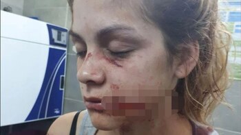 Imagen 3ZLEWCNMRBEK7FF3BKKK5OMJ2I