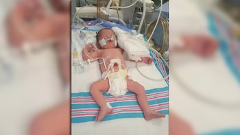 La bebita está en cuidados