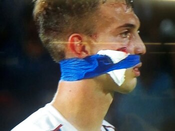 Así quedó Komar tras el