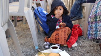La desnutrición infantil es muy severa a nivel mundial
