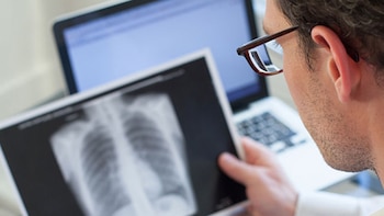 La tuberculosis tiene cura, sobre