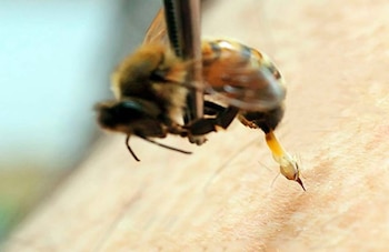 La apiterapia consiste en una