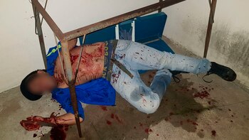 Nicolás Mansilla, tras intentar quitarse