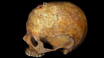 Los restos tenían un orificio