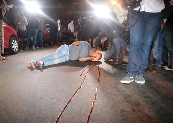 El hombre fue atropellado (Reuters/Leonardo