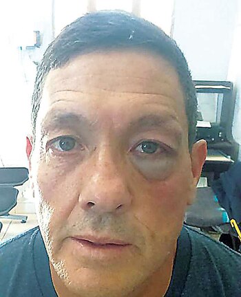 Mauricio Soria evidenció la agresión con una foto