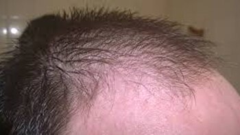 El producto argentino contra la