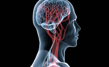Los derrames cerebrales se pueden controlar gracias a los fármacos que se han desarrollado en los últimos años (Cortesía)