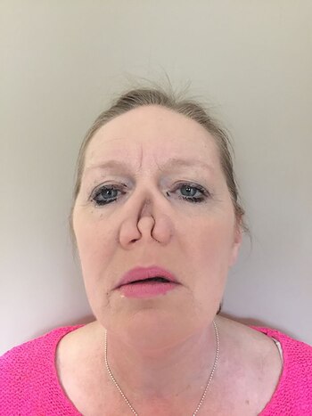 La enfermedad le fue pudriendo