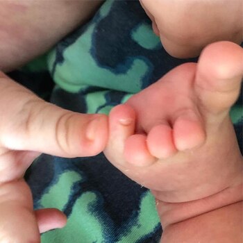 El pie de Dionisio y