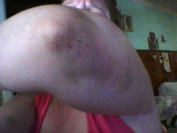 Fue golpeada en todo el