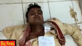 No es el primer caso