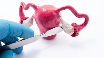 Científicos estudian por qué el