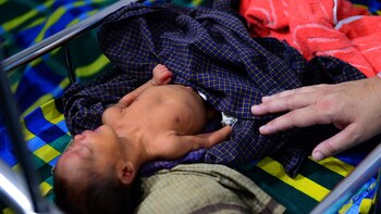 “Es inevitable que haya un