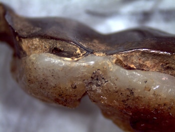 Otro detalle de los dientes