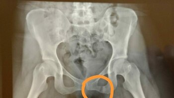 Imagen 5XF4FF4BERH23GVAXDTRS44OO4