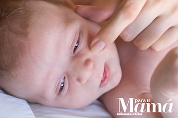 La ictericia se presenta en