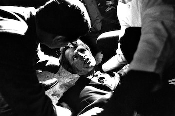 El rostro de “Bobby” tras