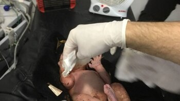 La pequeña luego de ser