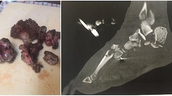 Imágenes cortesía de IncrediblyShinyShart