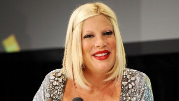 Tori Spelling se deforma la