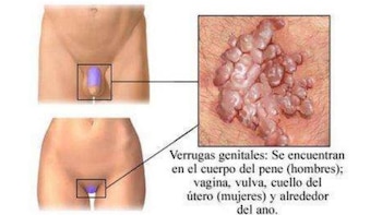 Efectos de la clamidia al