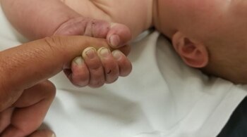 El bebé del milagro (Policía